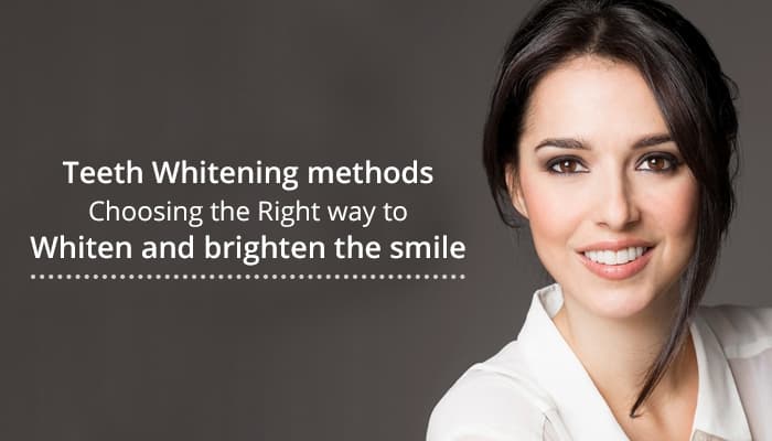 Teeth Whitening methods: Choosing the Right way to Whiten and brighten the smile